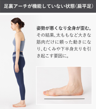 ランウェイキュアソールの偏平足